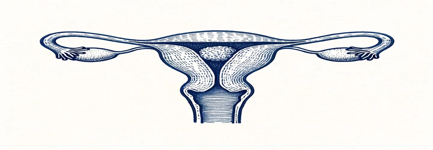 miyomlar ve tüp bebek tedavisi sürecindeki etkileri