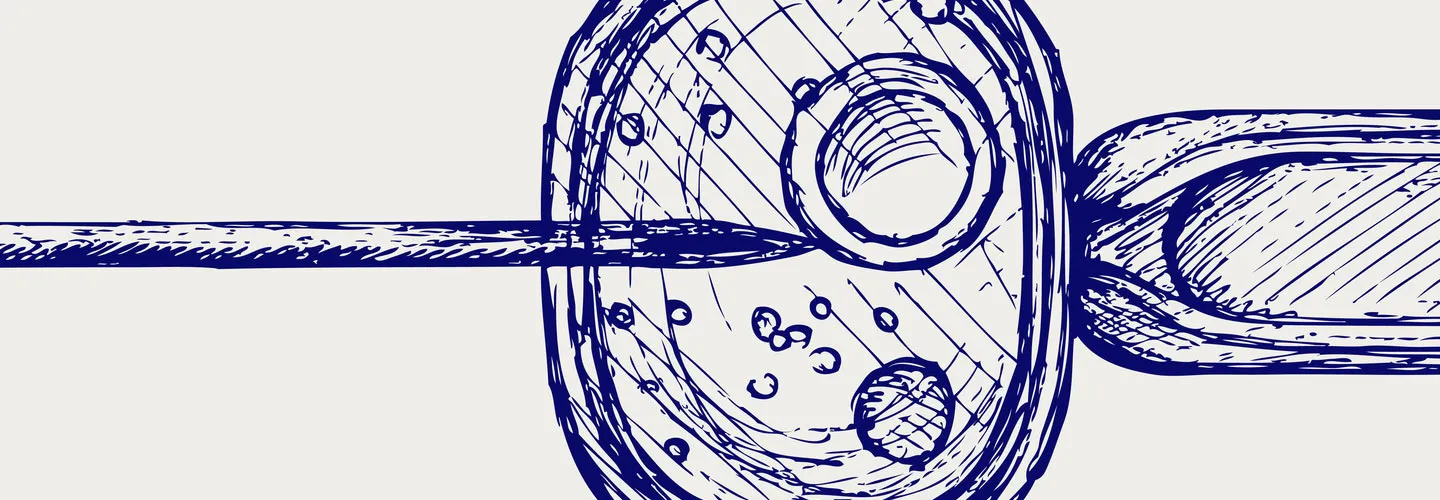 kadın kısırlığı tanı süreci ve tüp bebek tedavisi ICSI illüstrasyonu