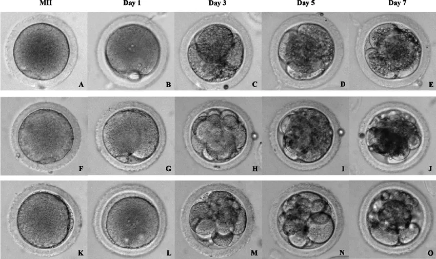 Tetikleme enjeksiyonu