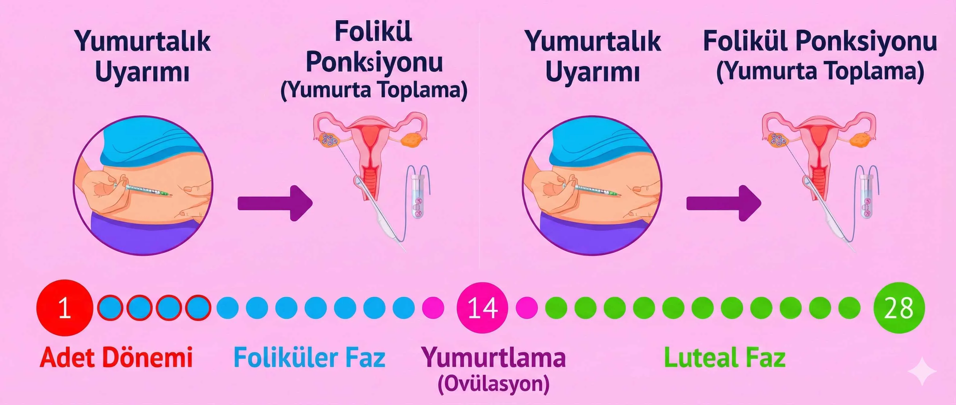 Gonadotropin enjeksiyonu